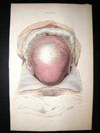 Anatomy Print 1826 Stomach Folio Hand Col. Lizars