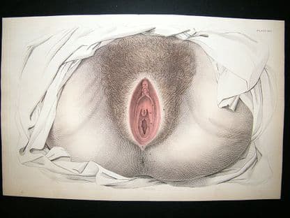 Anatomy Print 1826 Vagina. Folio Hand Col. Lizars | Albion Prints