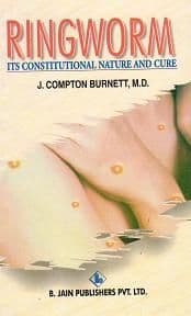 Burnett, J Compton - Ringworm: Its Constitutional Nature and Cure